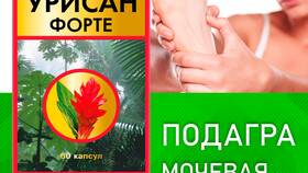 Что выводит мочевую кислоту при подагре в Фикс Прайс